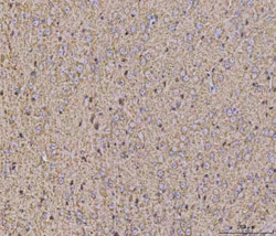 Invitrogen Calcineurin B Monoclonal Antibody (CN-A1) 100 &mu;g; Unconjugated:Antibodies,