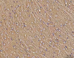 Invitrogen Calcineurin B Monoclonal Antibody (CN-A1) 100 &mu;g; Unconjugated:Antibodies,