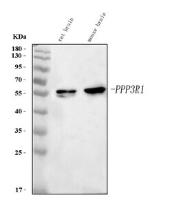 Invitrogen Calcineurin B Monoclonal Antibody (CN-A1) 100 &mu;g; Unconjugated:Antibodies,