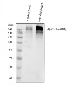 Dystrophin Monoclonal Antibody (MANDYS8), Invitrogen 100 &mu;g; Unconjugated:Antibodies,