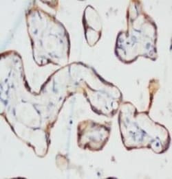 Invitrogen Cytokeratin 1 Antibody Cocktail 100 &mu;g; Unconjugated:Antibodies,
