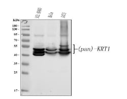 Invitrogen Cytokeratin 1 Antibody Cocktail 100 &mu;g; Unconjugated:Antibodies,