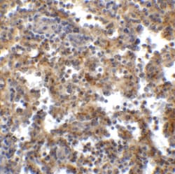 Invitrogen TIGIT Recombinant Llama Monoclonal Antibody (2C7) 100 &mu;g | Buy Online | Invitrogen&trade; | Fisher Scientific