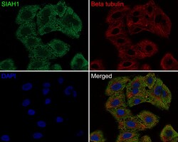 Invitrogen SIAH1 Recombinant Rabbit Monoclonal Antibody (PSH0-46) 100 &mu;L;