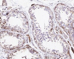 Invitrogen SIAH1 Recombinant Rabbit Monoclonal Antibody (PSH0-46) 100 &mu;L;