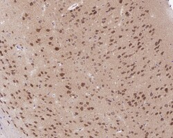 Invitrogen SIAH1 Recombinant Rabbit Monoclonal Antibody (PSH0-46) 100 &mu;L;