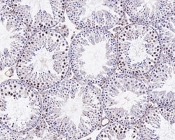 Invitrogen SIAH1 Recombinant Rabbit Monoclonal Antibody (PSH0-46) 100 &mu;L;