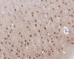Invitrogen SIAH1 Recombinant Rabbit Monoclonal Antibody (PSH0-46) 100 &mu;L;