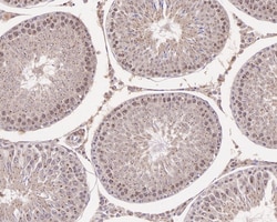 Invitrogen SIAH1 Recombinant Rabbit Monoclonal Antibody (PSH0-46) 100 &mu;L;