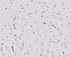 Invitrogen VISTA Recombinant Rabbit Monoclonal Antibody (PSH0-64) 100 &mu;L;
