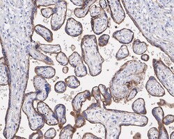 Invitrogen VISTA Recombinant Rabbit Monoclonal Antibody (PSH0-64) 100 &mu;L;