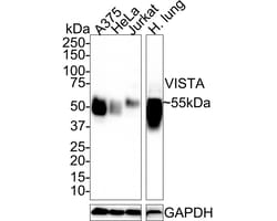 Invitrogen VISTA Recombinant Rabbit Monoclonal Antibody (PSH0-64) 100 &mu;L;