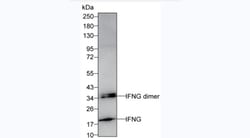 Invitrogen IFN gamma Monoclonal Antibody (KT218) 100 &mu;g; Unconjugated:Antibodies,