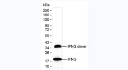 Invitrogen IFN gamma Monoclonal Antibody (5C7) 100 &mu;g; Unconjugated:Antibodies,
