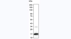 Invitrogen IL-2 Monoclonal Antibody (7E7) 100 &mu;L | Buy Online | Invitrogen&trade; | Fisher Scientific
