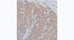Invitrogen GAPDH Monoclonal Antibody (KT186) 100 &mu;L; Unconjugated:Antibodies,