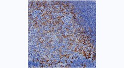 Invitrogen Complement C4a Monoclonal Antibody (24H12) 100 &mu;g; Unconjugated:Antibodies,