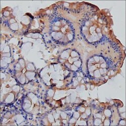 Invitrogen CD66e (CEA) Monoclonal Antibody (KT159) 100 &mu;g; Unconjugated:Antibodies,