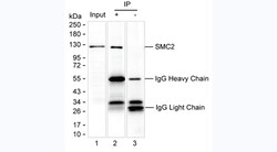 Invitrogen Acetyl-SMC2 (Lys114) Monoclonal Antibody (KT183) 100 &mu;g;