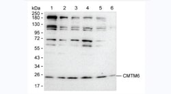 Invitrogen CMTM6 Monoclonal Antibody (RCT11) 100 &mu;g; Unconjugated:Antibodies,
