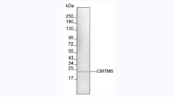 Invitrogen CMTM6 Monoclonal Antibody (RCT8) 100 &mu;L; Unconjugated:Antibodies,