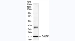 Invitrogen G-CSF Monoclonal Antibody (KT27) 100 &mu;L | Buy Online | Invitrogen&trade; | Fisher Scientific