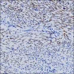 Invitrogen FGF2 Monoclonal Antibody (KT49) 100 &mu;g; Unconjugated:Antibodies,