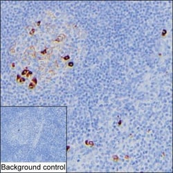 Invitrogen Human IgM Monoclonal Antibody (KT194) 100 &mu;g; Unconjugated:Antibodies,