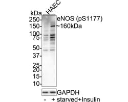 Invitrogen Phospho-eNOS (Ser1177) Recombinant Rabbit Monoclonal Antibody