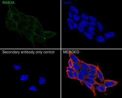 Invitrogen RAB3A Recombinant Rabbit Monoclonal Antibody (PSH01-08) 100