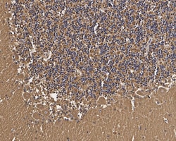Invitrogen RAB3A Recombinant Rabbit Monoclonal Antibody (PSH01-08) 100