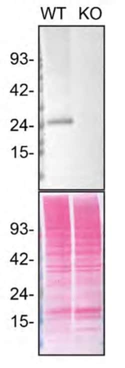 Invitrogen RAB3A Recombinant Rabbit Monoclonal Antibody (PSH01-08) 100