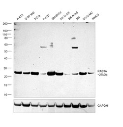 Invitrogen RAB3A Recombinant Rabbit Monoclonal Antibody (PSH01-08) 100