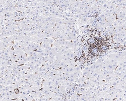 Invitrogen HCLS1 Recombinant Rabbit Monoclonal Antibody (PSH01-12) 100 &mu;L | Buy Online | Invitrogen&trade; | Fisher Scientific