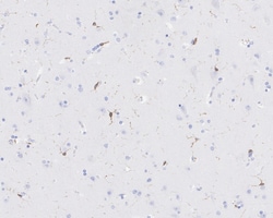 Invitrogen HCLS1 Recombinant Rabbit Monoclonal Antibody (PSH01-12) 100 &mu;L | Buy Online | Invitrogen&trade; | Fisher Scientific