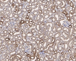 Invitrogen KEAP1 Recombinant Rabbit Monoclonal Antibody (PSH0-90) 100 &mu;L;