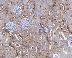 Invitrogen KEAP1 Recombinant Rabbit Monoclonal Antibody (PSH0-90) 100 &mu;L;