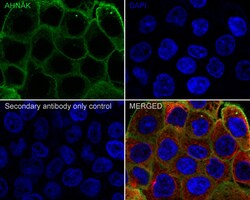 Invitrogen AHNAK Recombinant Rabbit Monoclonal Antibody (PSH01-10) 100