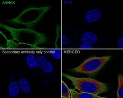 Invitrogen AHNAK Recombinant Rabbit Monoclonal Antibody (PSH01-10) 100