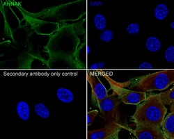 Invitrogen AHNAK Recombinant Rabbit Monoclonal Antibody (PSH01-10) 100