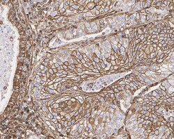 Invitrogen AHNAK Recombinant Rabbit Monoclonal Antibody (PSH01-10) 100