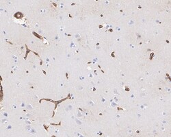 Invitrogen AHNAK Recombinant Rabbit Monoclonal Antibody (PSH01-10) 100