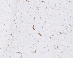 Invitrogen AHNAK Recombinant Rabbit Monoclonal Antibody (PSH01-10) 100