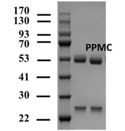 Invitrogen Propamocarb Monoclonal Antibody (2H10) 200 &mu;g; Unconjugated:Anticorps,