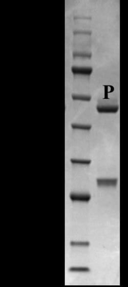 Invitrogen Progesterone Monoclonal Antibody (2D9) 200 &mu;g; Unconjugated:Antibodies,