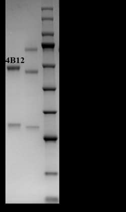 Invitrogen Digitoxin Monoclonal Antibody (4B12) 200 &mu;g; Unconjugated:Antibodies,