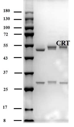 Invitrogen Cortisol Monoclonal Antibody (2F1) 200 &mu;g; Unconjugated:Antibodies,