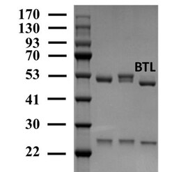 Invitrogen Butralin Monoclonal Antibody (3B4) 200 &mu;g; Unconjugated:Antikörper