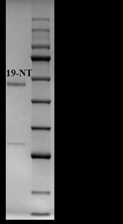 Invitrogen 19-methyltestosterone Monoclonal Antibody (D1) 200 &mu;g; Unconjugated:Antibodies,