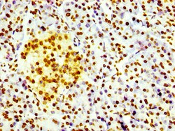 Invitrogen Phospho-Histone H1.4 (Thr17) Recombinant Rabbit Monoclonal Antibody